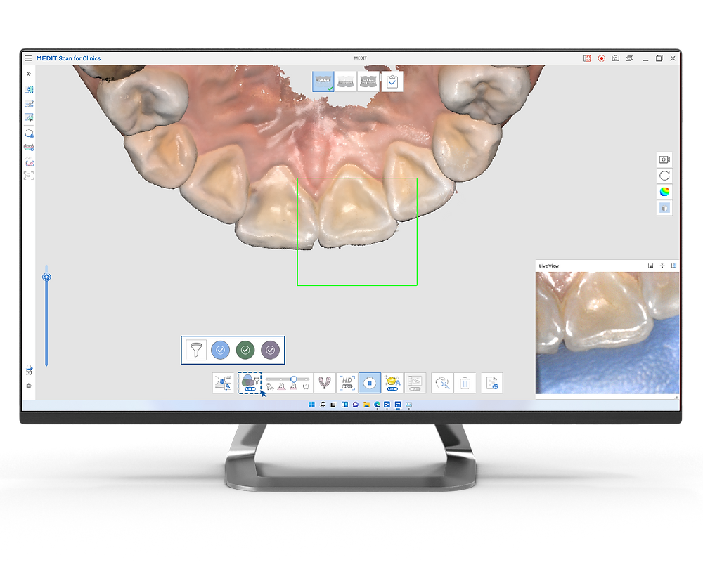 scanner intraoral 3D medit i700