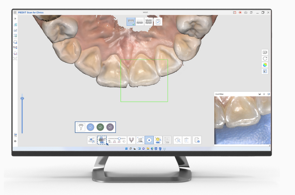 scanner intraoral 3D medit i700